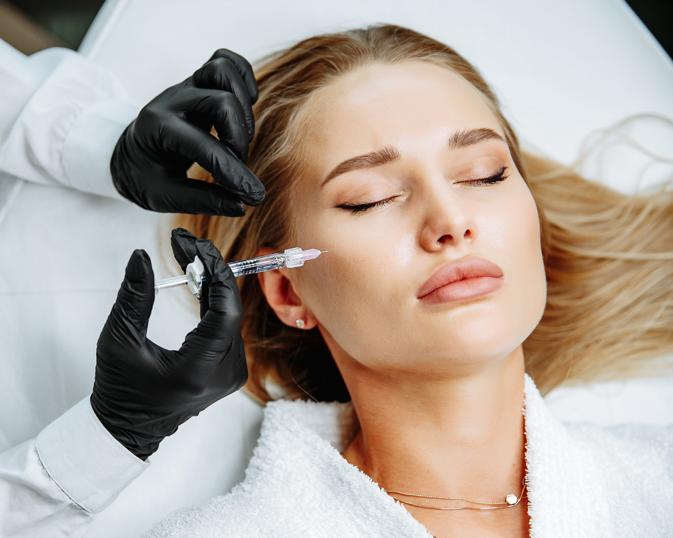 Radiesse biostimulator cheek treatment